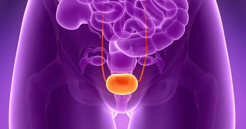 Cancerul vezicii urinare: cauze, simptome, diagnostic, tratament